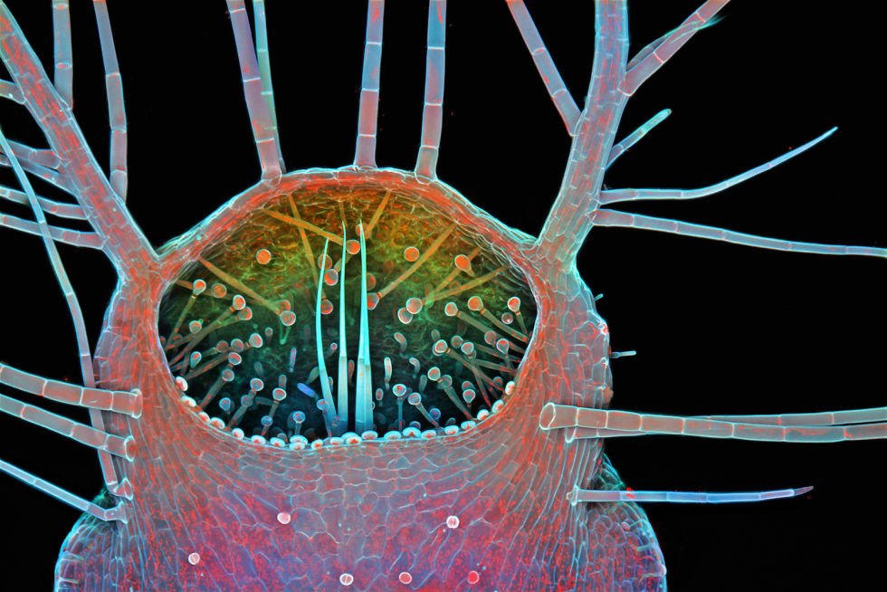 Microscopic treasures: Abstract art discovered under the microscope
