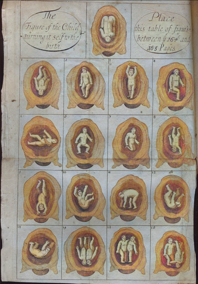 17th Century babies looked different in the womb