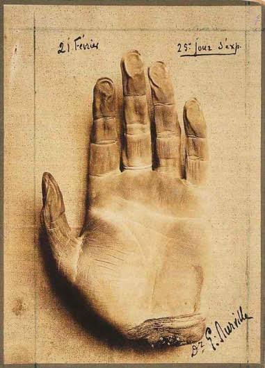 A macabre tale of a mummified hand frozen forever by mesmerism (1913)